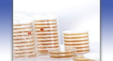 Dehydrated culture media